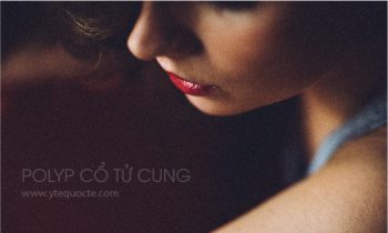 Polyp cổ tử cung nguyên nhân triệu chứng hỗ trợ điều trị