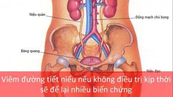 Khám viêm đường tiết niệu